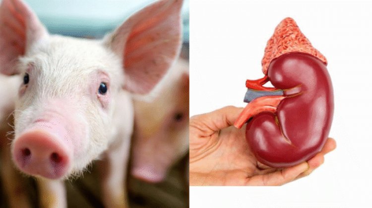 Fatwa Al-Azhar Izinkan Transplantasi Ginjal Babi ke Manusia, ini Tanggapan MUI