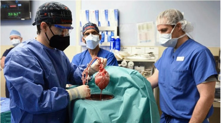 Pria Penerima Cangkok Jantung Babi Meninggal Setelah Bertahan 2 Bulan